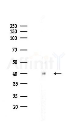 VEGFA Recombinant Rabbit mAb - Western blot analysis of lysates from HepG2 cells(starvation,24h treatment), using VEGFA Recombinant Rabbit mAb at 1/1000 dilution.