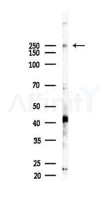 Phospho-mTOR (Ser2448) Recombinant Rabbit mAb - Western blot analysis of lysates from Hela cells(starvation, 24h treatment), using Phospho-mTOR (Ser2448) Recombinant Rabbit mAb at 1/1000 dilution.