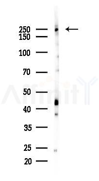 Phospho-mTOR (Ser2448) Recombinant Rabbit mAb - Western blot analysis of lysates from EC304 cells(starvation, 24h treatment), using Phospho-mTOR (Ser2448) Recombinant Rabbit mAb at 1/1000 dilution.