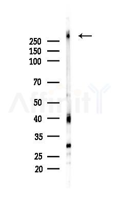 Phospho-mTOR (Ser2448) Recombinant Rabbit mAb - Western blot analysis of lysates from Rat brain, using Phospho-mTOR (Ser2448) Recombinant Rabbit mAb at 1/1000 dilution.