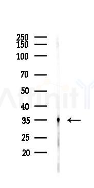 IKB alpha Recombinant Rabbit mAb - Western blot analysis of lysates from Mouse brain, using IKB alpha Recombinant Rabbit mAb at 1/1000 dilution.