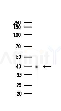 IKB alpha Recombinant Rabbit mAb - Western blot analysis of lysates from HepG2 cells(starvation,24h treatment), using IKB alpha Recombinant Rabbit mAb at 1/1000 dilution.