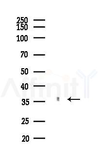 IKB alpha Recombinant Rabbit mAb - Western blot analysis of lysates from COLO205 cells(heat-shock,45min treatment), using IKB alpha Recombinant Rabbit mAb at 1/1000 dilution.