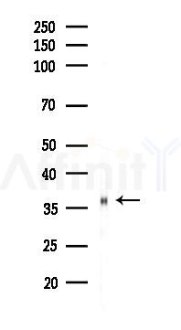 Phospho-IKB alpha (Ser32) Recombinant Rabbit mAb - Western blot analysis of lysates from Rat lung, using Phospho-IKB alpha (Ser32) Rabbit mAb at 1/1000 dilution.
