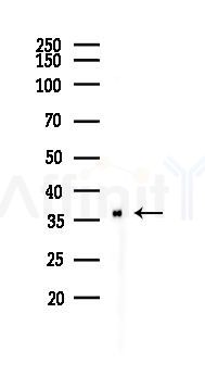 Phospho-IKB alpha (Ser32) Recombinant Rabbit mAb - Western blot analysis of lysates from HepG2 cells(heat-shock,45min treatment), using Phospho-IKB alpha (Ser32) Rabbit mAb at 1/1000 dilution.