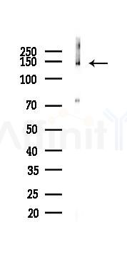 PERK Recombinant Rabbit mAb - Western blot analysis of lysates from HepG2 cells(starvation,24h treatment), using PERK Recombinant Rabbit mAb at 1/1000 dilution.