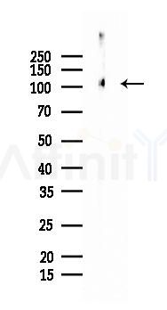 CD31 Recombinant Rabbit mAb - Western blot analysis of lysates from Mouse lung, using CD31 Recombinant Rabbit mAb at 1/1000 dilution.
