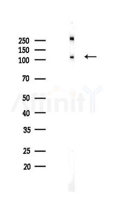 Phospho-Nrf2 (Ser40) Recombinant Rabbit mAb - Western blot analysis of lysates from HUVEC cells(LPS,4h treatment), using Phospho-Nrf2 (Ser40) Recombinant Rabbit mAb at 1/1000 dilution.