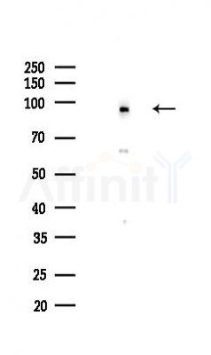 Phospho-Nrf2 (Ser40) Recombinant Rabbit mAb - Western blot analysis of lysates from HepG2 cells(starvation,24h treatment), using Phospho-Nrf2 (Ser40) Recombinant Rabbit mAb at 1/1000 dilution.