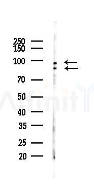 Phospho-STAT3 (Ser727) Recombinant Rabbit mAb - Western blot analysis of lysates from HepG2 cells(starvation,24h treatment), using Phospho-STAT3 (Ser727) Recombinant Rabbit mAb at 1/1000 dilution.