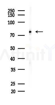 STAT3 Recombinant Rabbit mAb - Western blot analysis of lysates from Hela cells(starvation, 24h treatment), using STAT3 Recombinant Rabbit mAb at 1/1000 dilution.
