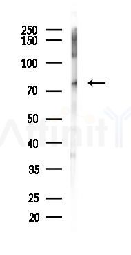 STAT3 Recombinant Rabbit mAb - Western blot analysis of lysates from EC304 cells(starvation, 24h treatment), using STAT3 Recombinant Rabbit mAb at 1/1000 dilution.