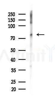 STAT3 Recombinant Rabbit mAb - Western blot analysis of lysates from Rat brain, using STAT3 Recombinant Rabbit mAb at 1/1000 dilution.