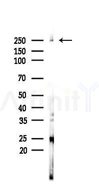 Phospho-mTOR (Ser2481) Recombinant Rabbit mAb - Western blot analysis of lysates from A375 cells(heat-shock,45min treatment), using Phospho-mTOR (Ser2481) Rabbit mAb at 1/1000 dilution.