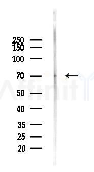 CD86 Recombinant Rabbit mAb - Western blot analysis of lysates from EC304 cells(starvation 24h treatment), using CD86 Recombinant Rabbit mAb at 1/1000 dilution.