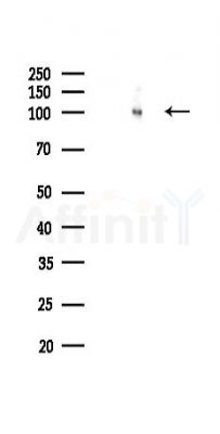 MMP9 Recombinant Rabbit mAb - Western blot analysis of lysates from Rat spleen, using MMP9 Recombinant Rabbit mAb at 1/1000 dilution.