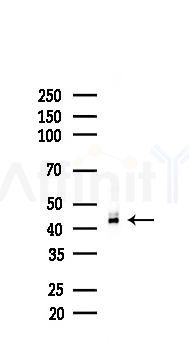 Phospho-JNK1/2/3 (Tyr185/Tyr185/Tyr223) Recombinant Rabbit mAb - Western blot analysis of lysates from A375 cells(heat-shock,45min treatment), using Phospho-JNK1/2/3 (Tyr185/Tyr185/Tyr223) Rabbit mAb at 1/1000 dilution.