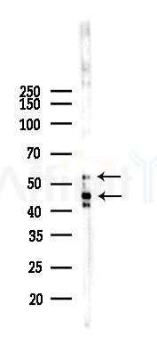 Phospho-JNK1/2/3 (Tyr185/Tyr185/Tyr223) Recombinant Rabbit mAb - Western blot analysis of lysates from HepG2 cells(heat-shock,45min treatment), using Phospho-JNK1/2/3 (Tyr185/Tyr185/Tyr223) Rabbit mAb at 1/1000 dilution.