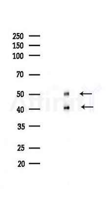 JNK1/JNK2/JNK3 Recombinant Rabbit mAb - Western blot analysis of lysates from HUVEC cells(LPS,4h treatment), using JNK1/JNK2/JNK3 Recombinant Rabbit mAb at 1/1000 dilution.
