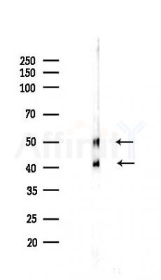 JNK1/JNK2/JNK3 Recombinant Rabbit mAb - Western blot analysis of lysates from HepG2 cells(starvation,24h treatment), using JNK1/JNK2/JNK3 Recombinant Rabbit mAb at 1/1000 dilution.