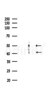 JNK1/JNK2/JNK3 Recombinant Rabbit mAb - Western blot analysis of lysates from Rat spleen, using JNK1/JNK2/JNK3 Recombinant Rabbit mAb at 1/1000 dilution.