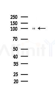 E-cadherin Recombinant Rabbit mAb - Western blot analysis of lysates from A375 cells(heat-shock,45min treatment), using pan Cadherin Rabbit mAb at 1/1000 dilution.