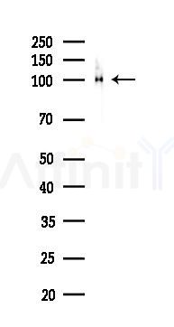 E-cadherin Recombinant Rabbit mAb - Western blot analysis of lysates from Rat lung, using pan Cadherin Rabbit mAb at 1/1000 dilution.
