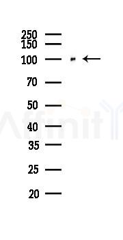 E-cadherin Recombinant Rabbit mAb - Western blot analysis of lysates from HepG2 cells(heat-shock,45min treatment), using pan Cadherin Rabbit mAb at 1/1000 dilution.