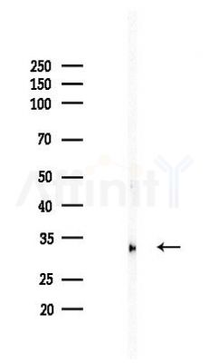 HO-1 Recombinant Rabbit mAb - Western blot analysis of lysates from HUVEC cells(LPS,4h treatment), using Heme Oxygenase 1 Recombinant Rabbit mAb at 1/1000 dilution.