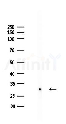 HO-1 Recombinant Rabbit mAb - Western blot analysis of lysates from HepG2 cells(starvation,24h treatment), using Heme Oxygenase 1 Recombinant Rabbit mAb at 1/1000 dilution.