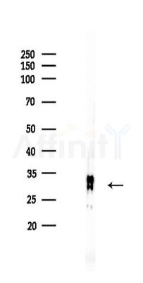 HO-1 Recombinant Rabbit mAb - Western blot analysis of lysates from Rat spleen, using Heme Oxygenase 1 Recombinant Rabbit mAb at 1/1000 dilution.