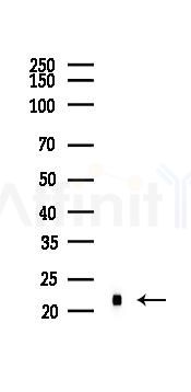 FTH1 Recombinant Rabbit mAb - Western blot analysis of lysates from Mouse brain, using Ferritin Heavy Chain Recombinant Rabbit mAb at 1/1000 dilution.