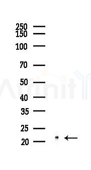 FTH1 Recombinant Rabbit mAb - Western blot analysis of lysates from HepG2 cells(starvation,24h treatment), using Ferritin Heavy Chain Recombinant Rabbit mAb at 1/1000 dilution.