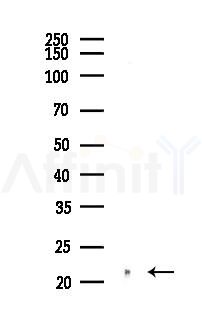 FTH1 Recombinant Rabbit mAb - Western blot analysis of lysates from COLO205 cells(heat-shock,45min treatment), using Ferritin Heavy Chain Recombinant Rabbit mAb at 1/1000 dilution.