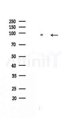 beta Catenin Recombinant Rabbit mAb - Western blot analysis of lysates from HUVEC cells(LPS,4h treatment), using beta Catenin Recombinant Rabbit mAb at 1/1000 dilution.