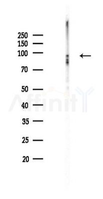 beta Catenin Recombinant Rabbit mAb - Western blot analysis of lysates from Rat spleen, using beta Catenin Recombinant Rabbit mAb at 1/1000 dilution.