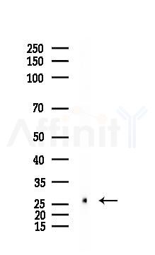 IL6 Recombinant Rabbit mAb - Western blot analysis of lysates from Rat liver, using IL-6 Recombinant Rabbit mAb at 1/1000 dilution.