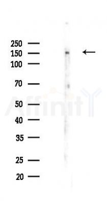 E-cadherin Recombinant Rabbit mAb - Western blot analysis of lysates from HUVEC cells(LPS,4h treatment), using E-Cadherin Recombinant Rabbit mAb at 1/1000 dilution.