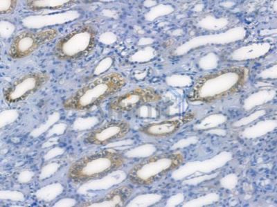 E-cadherin Recombinant Rabbit mAb - BF3053 at 1/100 staining human normal kidney tissue by IHC-P.