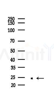 IL18 Recombinant Rabbit mAb - Western blot analysis of lysates from HepG2 cells(starvation,24h treatment), using IL-18 Recombinant Rabbit mAb at 1/1000 dilution.