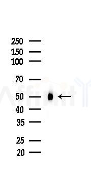 IRF3 Recombinant Rabbit mAb - Western blot analysis of lysates from A375 cells(heat-shock,45min treatment), using IRF3 Rabbit mAb at 1/1000 dilution.
