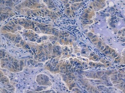 IRF3 Recombinant Rabbit mAb - BF3058 at 1/100 staining human normal lung tissue by IHC-P.