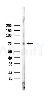 CD68 Recombinant Rabbit mAb - Western blot analysis of lysates from A375 cells(heat-shock,45min treatment), using CD68 Rabbit mAb at 1/1000 dilution.