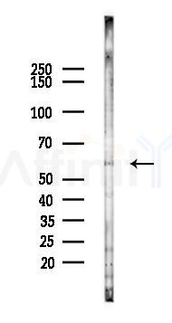 PPAR gamma Recombinant Rabbit mAb - Western blot analysis of lysates from A2780 cells(starvation 24h treatment), using PPAR gamma Recombinant Rabbit mAb at 1/1000 dilution.