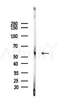 PPAR gamma Recombinant Rabbit mAb - Western blot analysis of lysates from Rat lung, using PPAR gamma Recombinant Rabbit mAb at 1/1000 dilution.