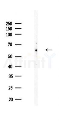 Beclin 1 Recombinant Rabbit mAb - Western blot analysis of lysates from Rat spleen, using Beclin 1 Recombinant Rabbit mAb at 1/1000 dilution.
