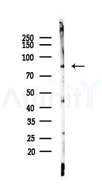 TBK1 Recombinant Rabbit mAb - Western blot analysis of lysates from HepG2 cells(starvation,24h treatment), using TBK1 Recombinant Rabbit mAb at 1/1000 dilution.