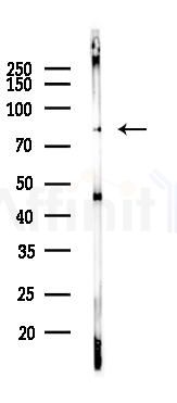 TBK1 Recombinant Rabbit mAb - Western blot analysis of lysates from COLO205 cells(heat-shock,45min treatment), using TBK1 Recombinant Rabbit mAb at 1/1000 dilution.