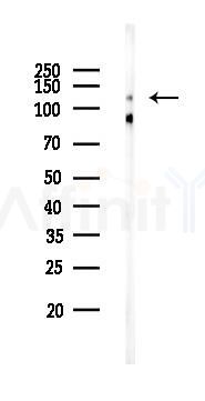 Phospho-JAK2 (Tyr1007/Tyr1008) Recombinant Rabbit mAb - Western blot analysis of lysates from EC304 cells(starvation 24h treatment), using Phospho-JAK2 (Tyr1007/Tyr1008) Recombinant Rabbit mAb at 1/1000 dilution.