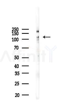 Phospho-JAK2 (Tyr1007/Tyr1008) Recombinant Rabbit mAb - Western blot analysis of lysates from PC12 cells(LPS 4h treatment), using Phospho-JAK2 (Tyr1007/Tyr1008) Recombinant Rabbit mAb at 1/1000 dilution.